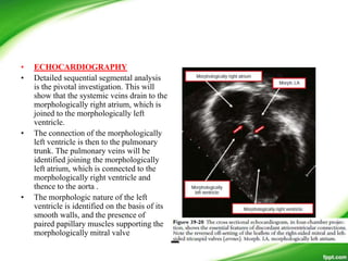 • ECHOCARDIOGRAPHY
• Detailed sequential segmental analysis
is the pivotal investigation. This will
show that the systemic veins drain to the
morphologically right atrium, which is
joined to the morphologically left
ventricle.
• The connection of the morphologically
left ventricle is then to the pulmonary
trunk. The pulmonary veins will be
identified joining the morphologically
left atrium, which is connected to the
morphologically right ventricle and
thence to the aorta .
• The morphologic nature of the left
ventricle is identified on the basis of its
smooth walls, and the presence of
paired papillary muscles supporting the
morphologically mitral valve
 