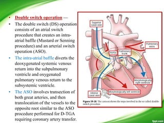 • Double switch operation —
• The double switch (DS) operation
consists of an atrial switch
procedure that creates an intra-
atrial baffle (Mustard or Senning
procedure) and an arterial switch
operation (ASO).
• The intra-atrial baffle diverts the
deoxygenated systemic venous
return into the subpulmonary
ventricle and oxygenated
pulmonary venous return to the
subsystemic ventricle.
• The ASO involves transection of
both great arteries, and then
translocation of the vessels to the
opposite root similar to the ASO
procedure performed for D-TGA
requiring coronary artery transfer.
 