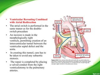• Ventricular Rerouting Combined
with Atrial Redirection
• The atrial switch is performed in the
same manor as for the double-
switch procedure
• An incision is made in the
morphologically right
ventricle, permitting creation of an
intraventricular tunnel between the
ventricular septal defect and the
aorta.
• In creating this tunnel, care has to
be taken to avoid any subaortic
stenosis.
• The repair is completed by placing
a valved conduit from the right
ventriculotomy to the pulmonary
arteries.
 