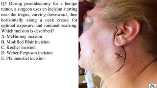 Parotid Incision Types Salivary Glands / Salivary Glands / Salivary Glands.pdf