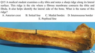 L003 Lower Limb Bone / Lower Limb Bone .pdf