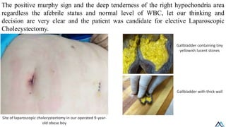 Liver biliary system / Liver biliary system.pdf