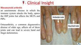 Mpcjs Hand L017 Upper Limb Joints / Upper Limb Joints / Upper Limb Joints.pdf