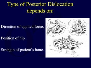 Type of Posterior Dislocation
depends on:
Direction of applied force.
Position of hip.
Strength of patient’s bone.
 