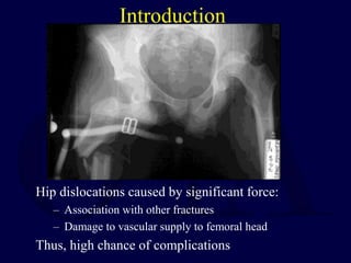 Introduction
Hip dislocations caused by significant force:
– Association with other fractures
– Damage to vascular supply to femoral head
Thus, high chance of complications
 