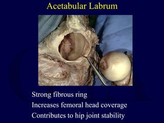 Acetabular Labrum
Strong fibrous ring
Increases femoral head coverage
Contributes to hip joint stability
 