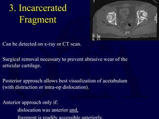 3. Incarcerated
Fragment
Can be detected on x-ray or CT scan.
Surgical removal necessary to prevent abrasive wear of the
articular cartilage.
Posterior approach allows best visualization of acetabulum
(with distraction or intra-op dislocation).
Anterior approach only if:
dislocation was anterior and,
 