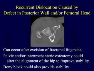 Recurrent Dislocation Caused by
Defect in Posterior Wall and/or Femoral Head
Can occur after excision of fractured fragment.
Pelvic and/or intertrochanteric osteotomy could
alter the alignment of the hip to improve stability.
Bony block could also provide stability.
 