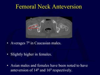 Femoral Neck Anteversion
• Averages 70 in Caucasian males.
• Slightly higher in females.
• Asian males and females have been noted to have
anteversion of 140 and 160 respectively.
 