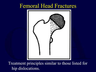 Femoral Head Fractures
Treatment principles similar to those listed for
hip dislocations.
 