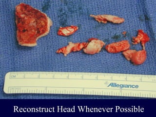 Reconstruct Head Whenever Possible
 