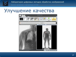Улучшение качества 