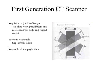 First Generation CT Scanner
Acquire a projection (X-ray)
Translate x-ray pencil beam and
detector across body and record
output
Rotate to next angle
Repeat translation
Assemble all the projections.
 
