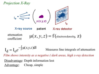 Projection X-Ray
Disadvantage: Depth information lost
Advantage: Cheap, simple
)
z
(
f
)
,
,
(
μ density
electron ,
z
y
x 
attenuation
coefficient
Measures line integrals of attenuation


 )dl
μ(
o
d I
I
x,y,z
e
Film shows intensity as a negative ( dark areas, high x-ray detection
 