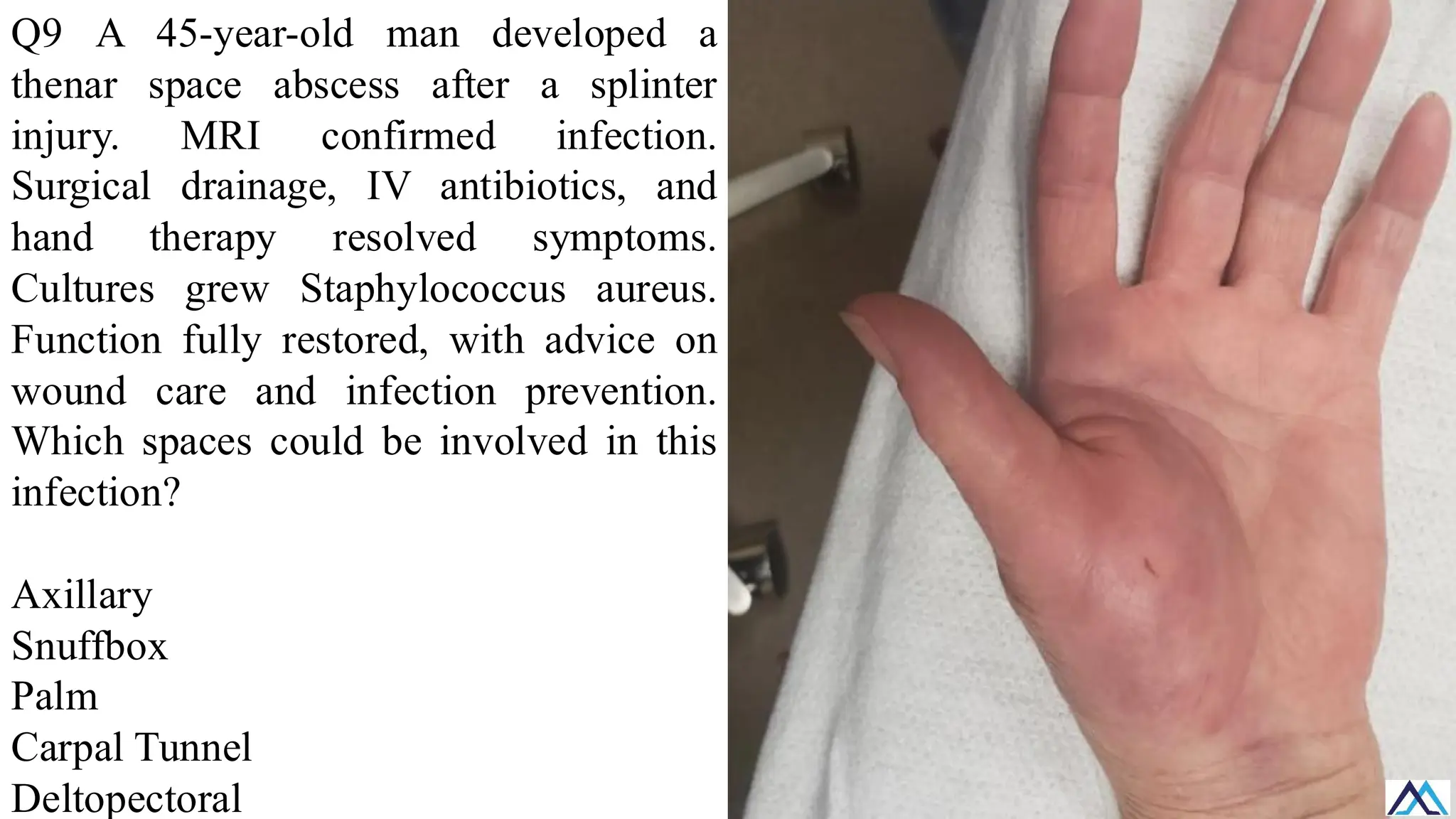 L020 Upper Limb Anatomical regions / Upper Limb Anatomical regions ...