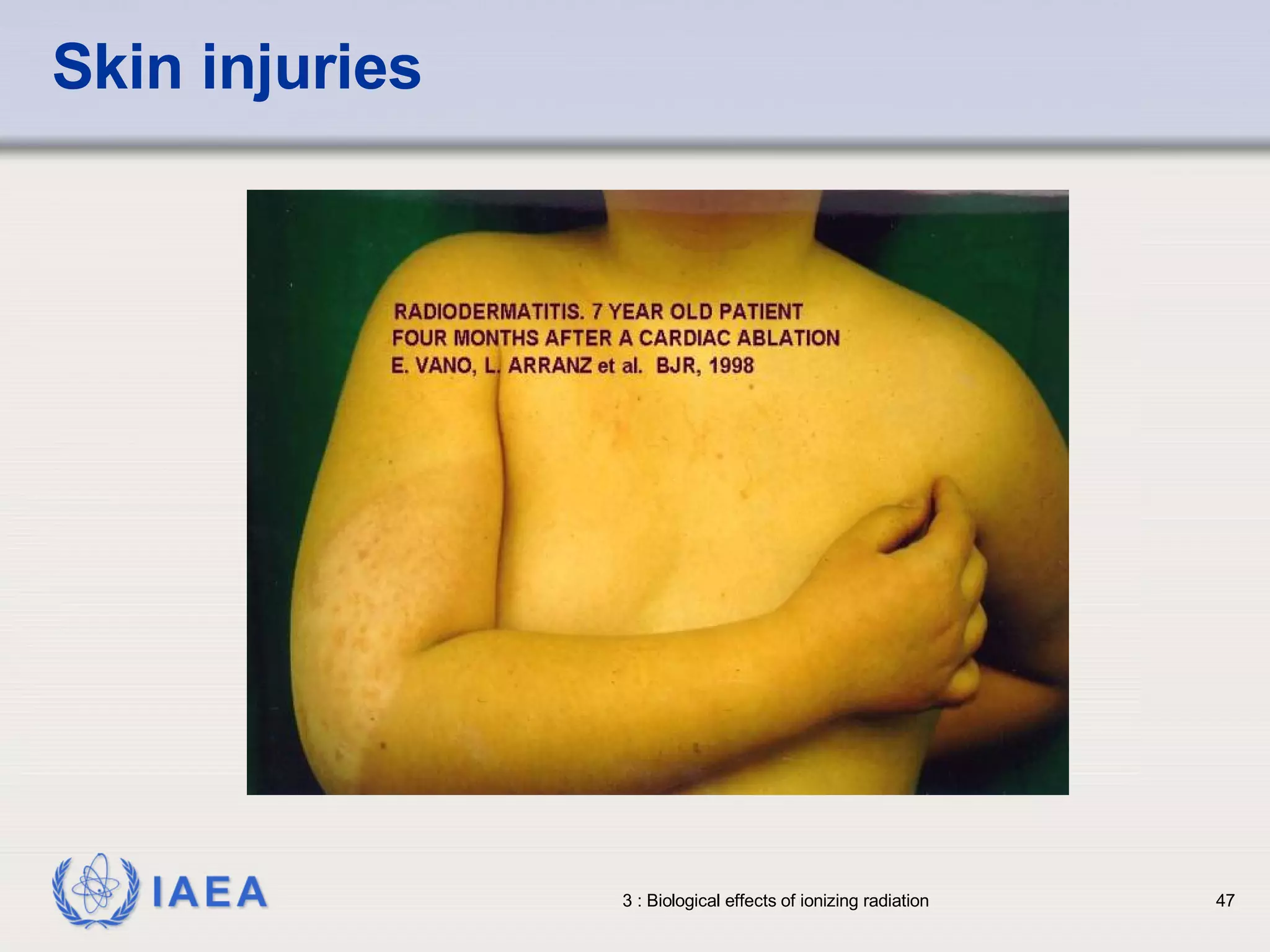 Skin injuries 