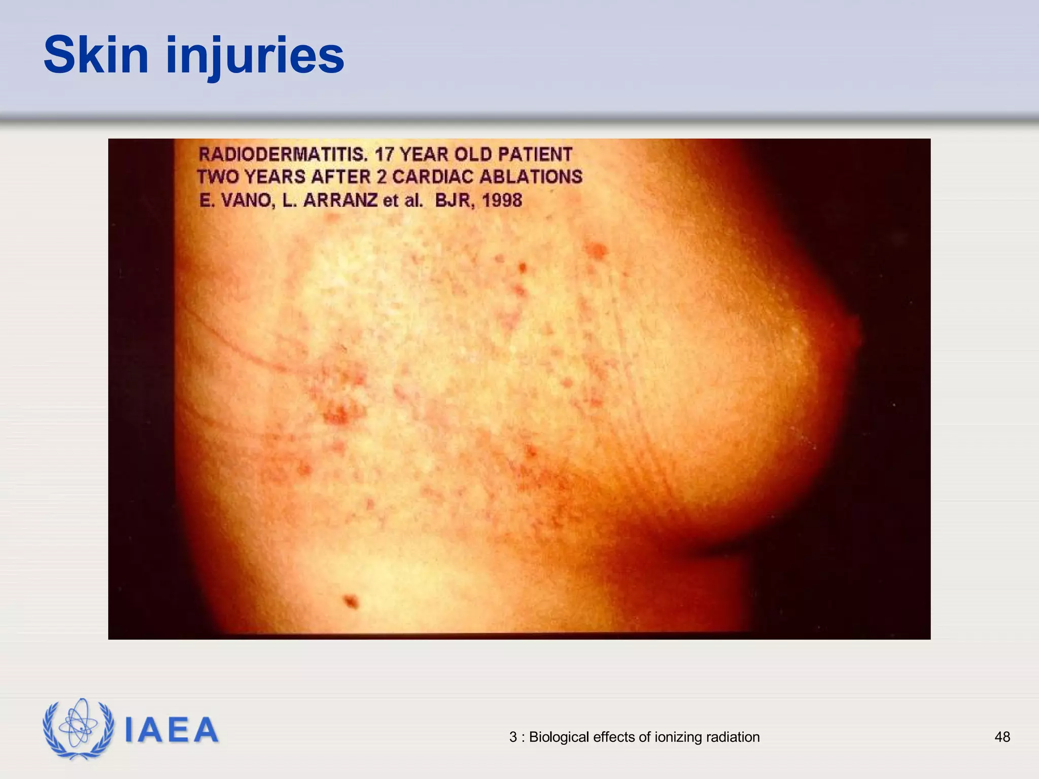 Skin injuries 