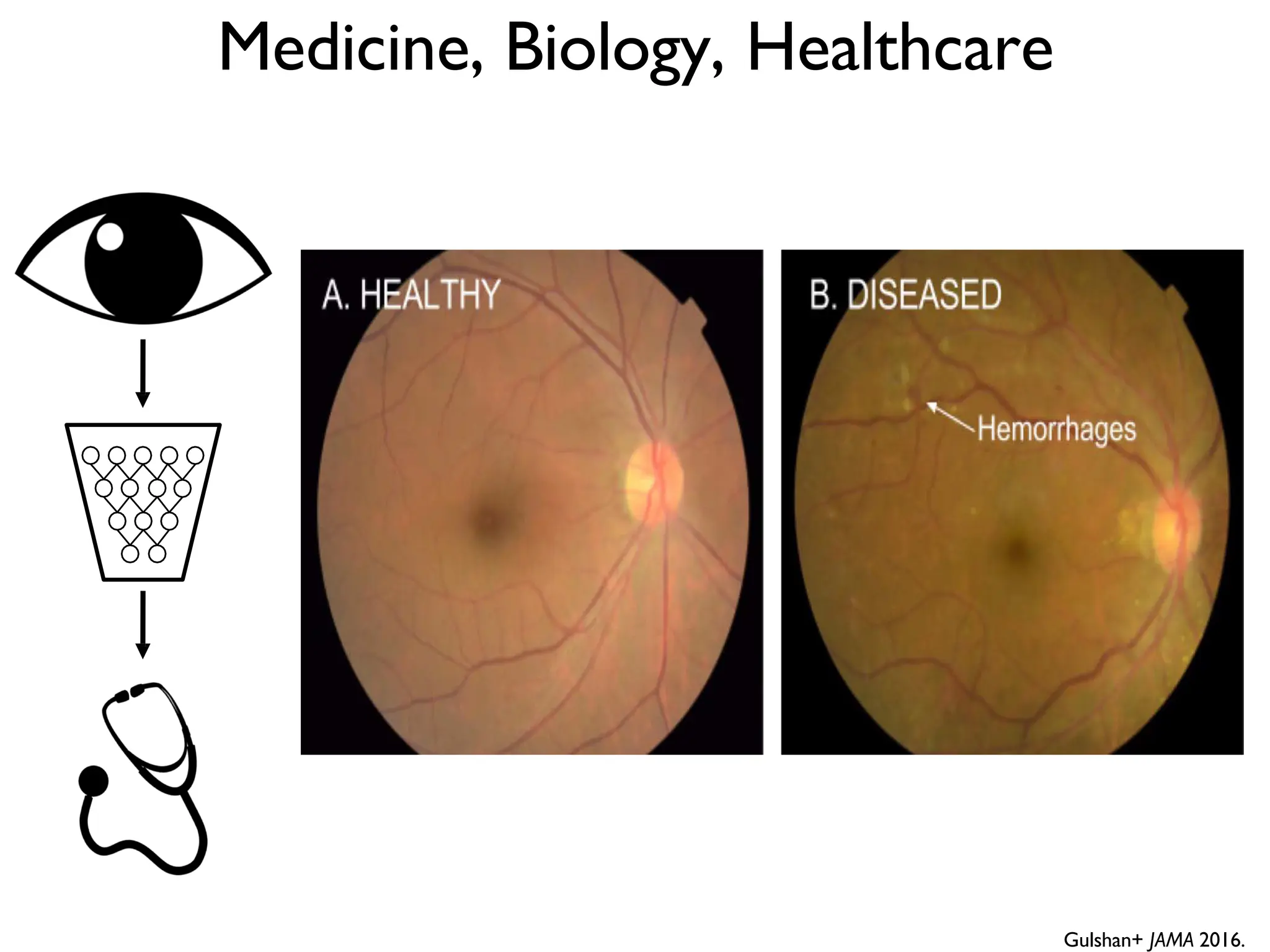 Medicine, Biology, Healthcare Gulshan+ JAMA 2016. 