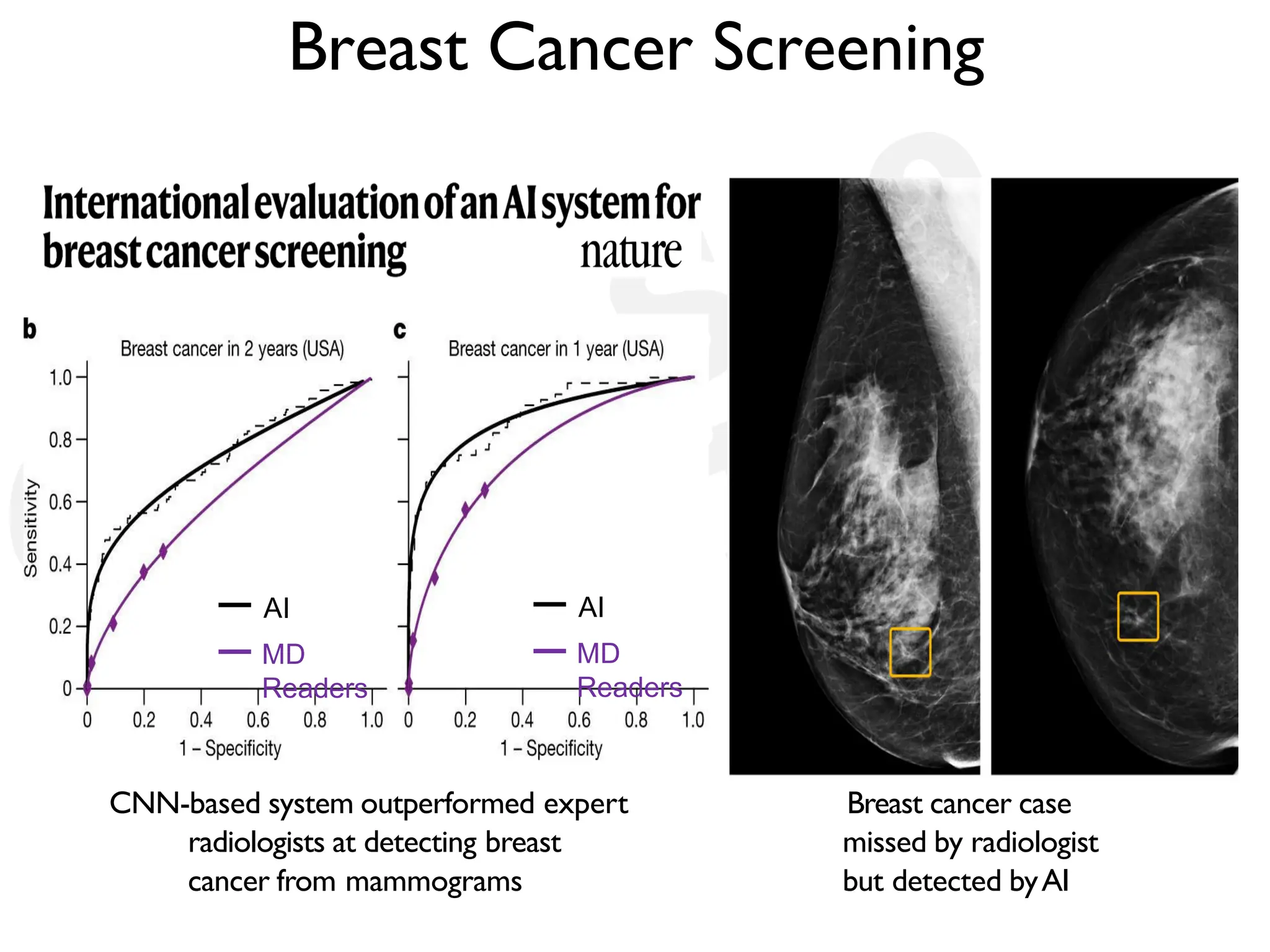 Breast Cancer Screening 6 . Breast cancer case missed by radiologist but detected byAI AI MD Readers AI MD Readers CNN-based system outperformed expert radiologists at detecting breast cancer from mammograms 