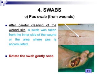 21
4. SWABS
 After careful cleaning of the
wound site, a swab was taken
from the inner side of the wound
or the area where pus is
accumulated.
 Rotate the swab gently once.
e) Pus swab (from wounds)
 