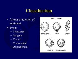 Classification
• Allows prediction of
treatment
• Types
– Transverse
– Marginal
– Vertical
– Comminuted
– Osteochondral
 
