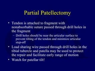 Partial Patellectomy
• Tendon is attached to fragment with
nonabsorbable suture passed through drill holes in
the fragment
– Drill holes should be near the articular surface to
prevent tilting of the tendon and minimize articular
step-off
• Load sharing wire passed through drill holes in the
tibial tubercle and patella may be used to protect
the repair and facilitate early range of motion
• Watch for patellar tilt!
 