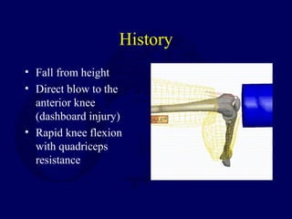 History
• Fall from height
• Direct blow to the
anterior knee
(dashboard injury)
• Rapid knee flexion
with quadriceps
resistance
 