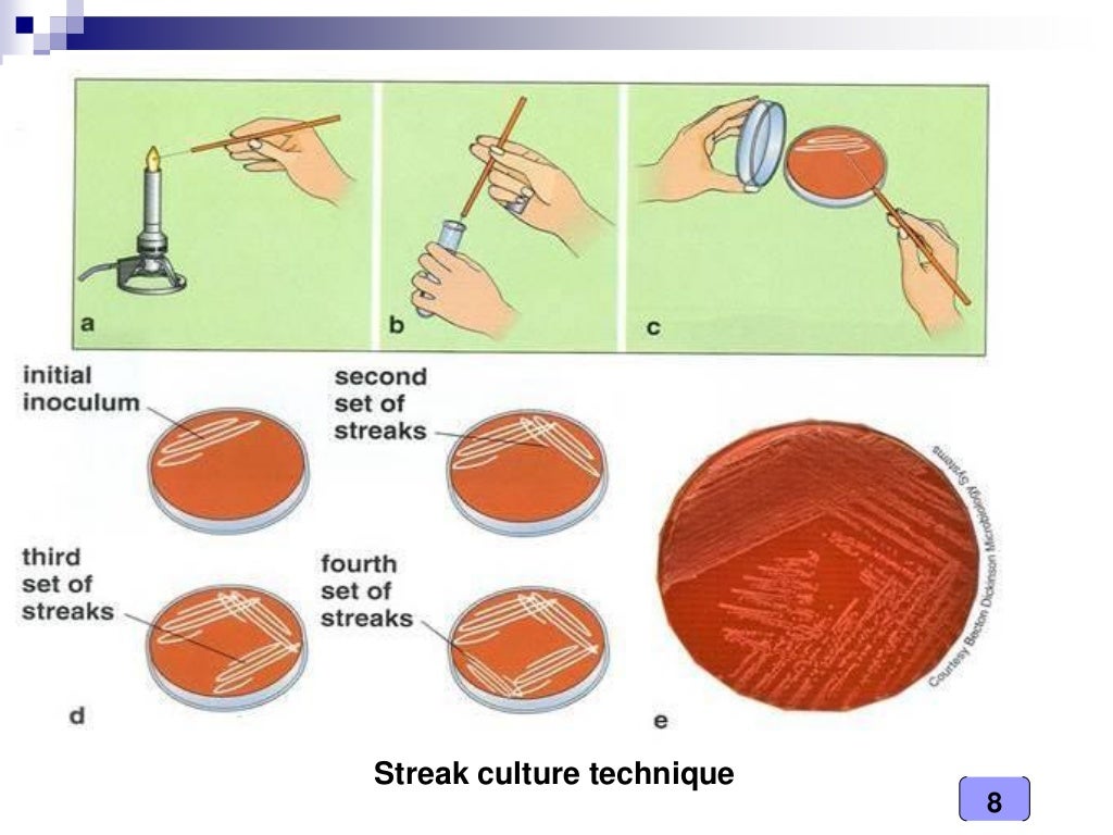 Medical Microbiology Laboratory (culture techniques)