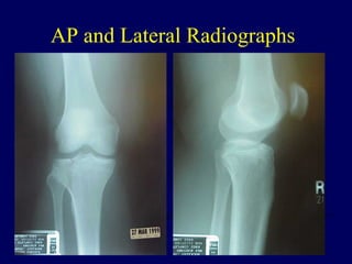 AP and Lateral Radiographs
 