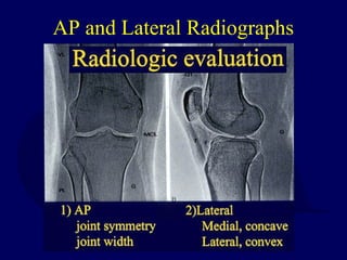 AP and Lateral Radiographs
 