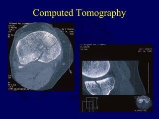 Computed Tomography
 