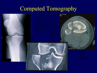 Computed Tomography
 