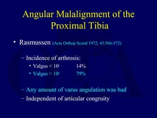 Angular Malalignment of the
Proximal Tibia
• Rasmussen (Acta Orthop Scand 1972; 43:566-572)
– Incidence of arthrosis:
• Valgus < 10o
14%
• Valgus > 10o
79%
– Any amount of varus angulation was bad
– Independent of articular congruity
 