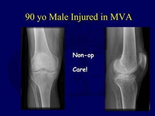 90 yo Male Injured in MVA
Non-op
Care!
 