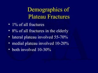 Demographics of
Plateau Fractures
• 1% of all fractures
• 8% of all fractures in the elderly
• lateral plateau involved 55-70%
• medial plateau involved 10-20%
• both involved 10-30%
 