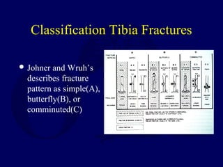 Classification Tibia Fractures
 Johner and Wruh’s
describes fracture
pattern as simple(A),
butterfly(B), or
comminuted(C)
 