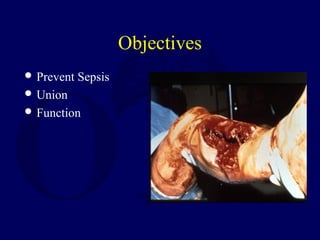 Objectives
 Prevent Sepsis
 Union
 Function
 