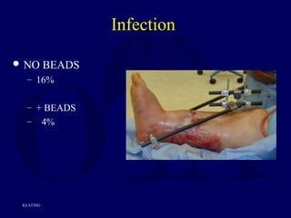 Infection
 NO BEADS
– 16%
– + BEADS
– 4%
KEATING
 