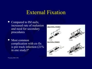 External Fixation
 Compared to IM nails,
increased rate of malunion
and need for secondary
procedures
 Most common
complication with ex-fix
is pin track infection (21%
in one study)*
*Tornetta JBJS 1994
 