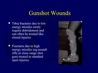 Gunshot Wounds
 Tibia fractures due to low
energy missiles rarely
require debridement and
can often be treated like
closed injuries
 Fractures due to high
energy missiles (eg assault
rifle or close range shot
gun) treated as standard
open injuries
 