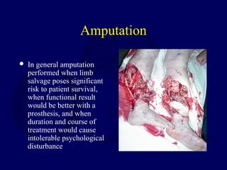 Amputation
 In general amputation
performed when limb
salvage poses significant
risk to patient survival,
when functional result
would be better with a
prosthesis, and when
duration and course of
treatment would cause
intolerable psychological
disturbance
 