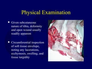 Physical Examination
 Given subcutaneous
nature of tibia, deformity
and open wound usually
readily apparent
 Circumferential inspection
of soft tissue envelope,
noting any lacerations,
ecchymosis, swelling, and
tissue turgidity
 