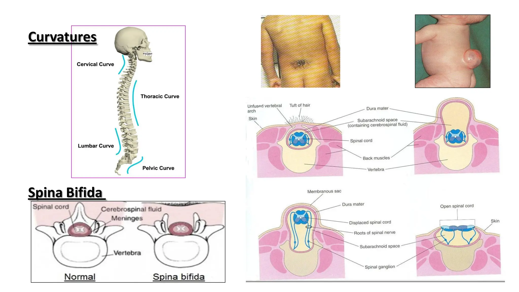 L1- Embryological development of the spinal cord and vertebral column.pdf