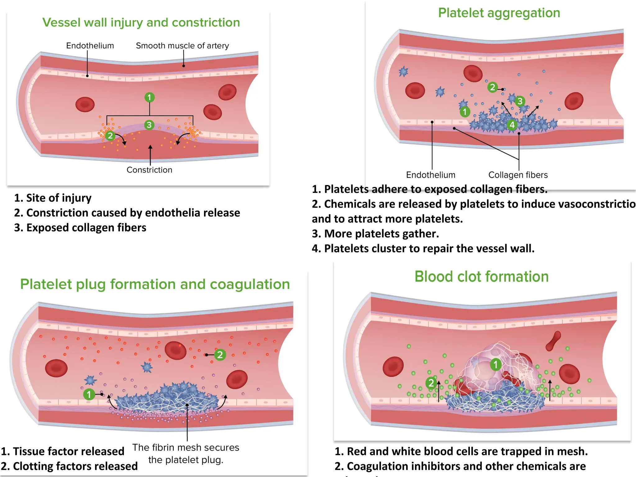 1. Platelets adhere to exposed collagen fibers.
2. Chemicals are released by platelets to induce vasoconstriction
and to attract more platelets.
3. More platelets gather.
4. Platelets cluster to repair the vessel wall.
1. Red and white blood cells are trapped in mesh.
2. Coagulation inhibitors and other chemicals are
1. Site of injury
2. Constriction caused by endothelia release
3. Exposed collagen fibers
1. Tissue factor released
2. Clotting factors released
 
