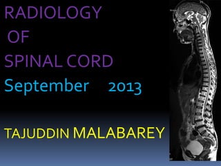RADIOLOGY
OF
SPINAL CORD
September 2013
TAJUDDIN MALABAREY
 
