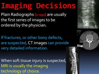 Imaging Decisions
Plain Radiographs (x-rays) are usually
the first series of images to be
ordered by the physician.
If fractures, or other bony defects,
are suspected, CT images can provide
very detailed information.
When soft tissue injury is suspected,
MRI is usually the imaging
technology of choice.
 