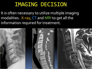 IMAGING DECISION
It is often necessary to utilize multiple imaging
modalities. X-ray, CT and MRI to get all the
information required for treatment.
 