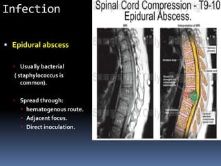 Infection
 Epidural abscess
 Usually bacterial
( staphylococcus is
common).
 Spread through:
 hematogenous route.
 Adjacent focus.
 Direct inoculation.
 