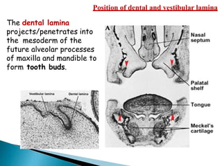 Position of dental and vestibular lamina
The dental lamina
projects/penetrates into
the mesoderm of the
future alveolar processes
of maxilla and mandible to
form tooth buds.
 