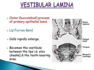 ➢ Outer (buccolabial) process
of primary epithelial band.
➢ Lip Furrow Band
➢ Cells rapidly enlarge.
➢ Becomes the vestibule
between the lips (& also
cheeks) & the tooth-bearing
area.
 